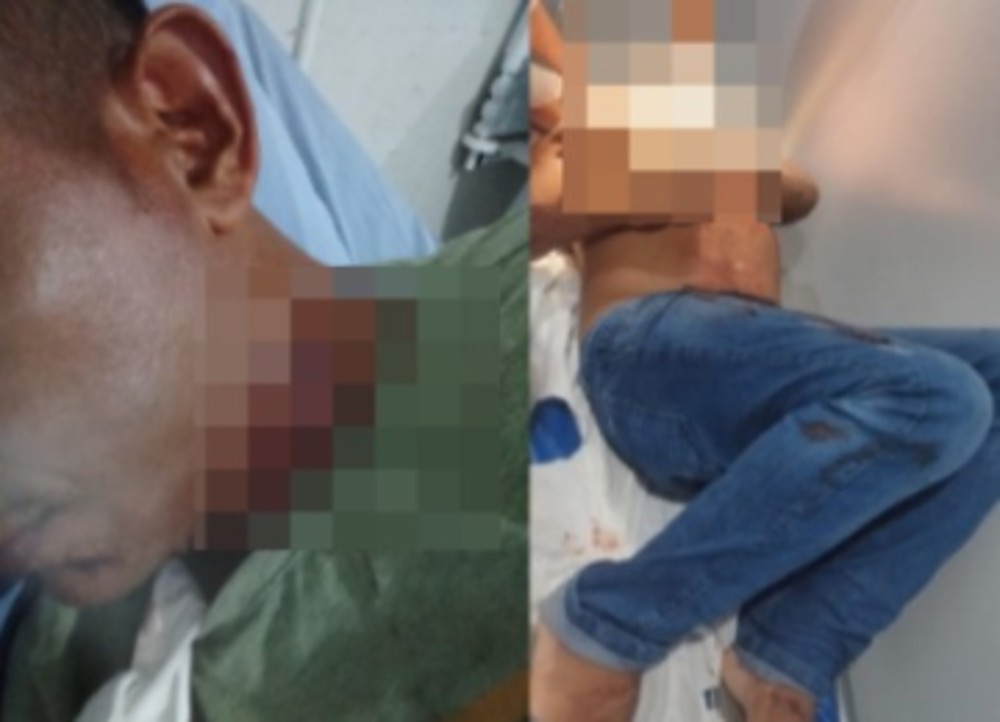 Homem é esfaqueado pelo próprio primo e escapa de tentativa de homicídio em RO