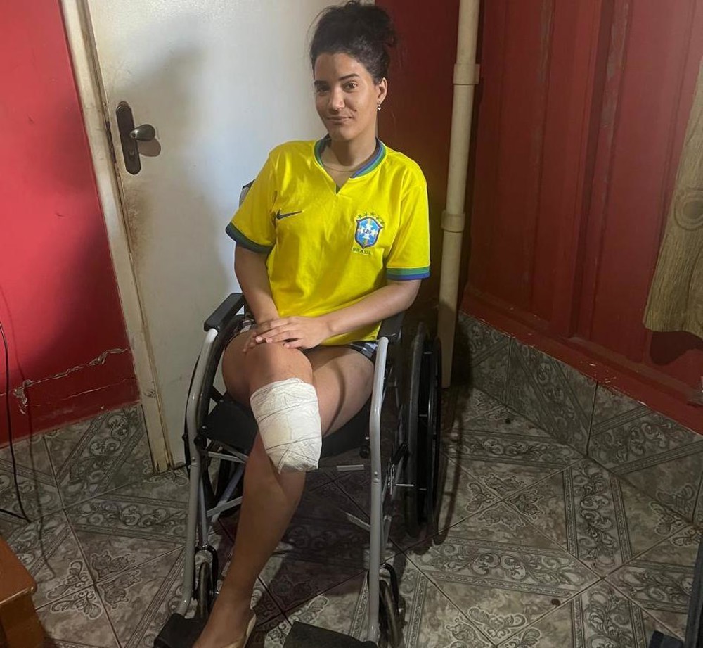 Jovem de Jaru sofre acidente, tem perna amputada e pede ajuda para adquirir prótese