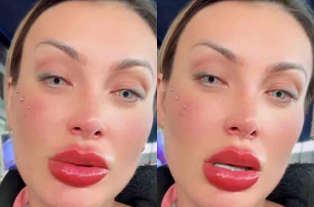 “Já estou arrependida”, diz Andressa Urach após cirurgia para mudar cor dos olhos 