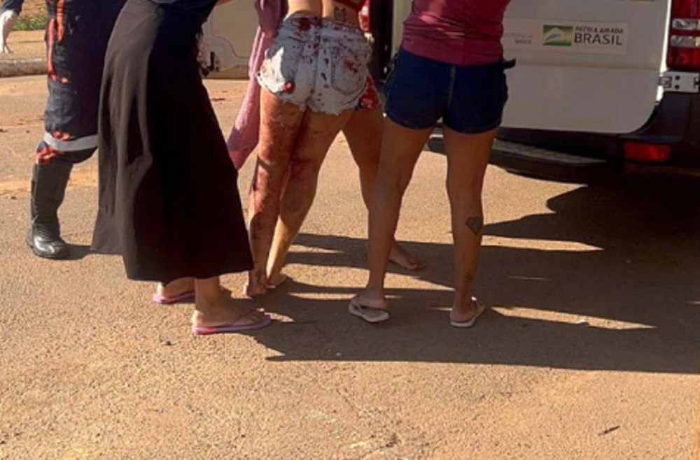 Homem é atacado a facada pela esposa depois de aniversário