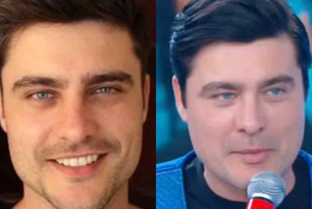 Guilherme Leicam vira assunto nas redes após mudança no rosto: “Desarmonização”