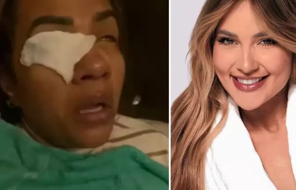 Mulher diz ter ficado cega após usar produto de Virginia Fonseca